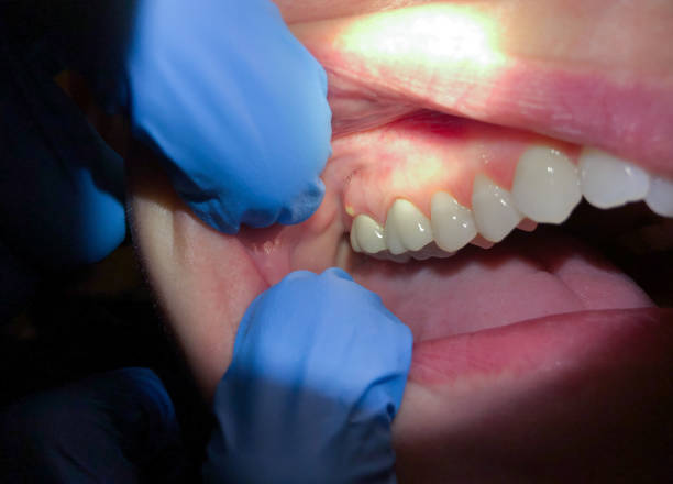 Best Dentist for Severe Toothache  in Council Grove, KS